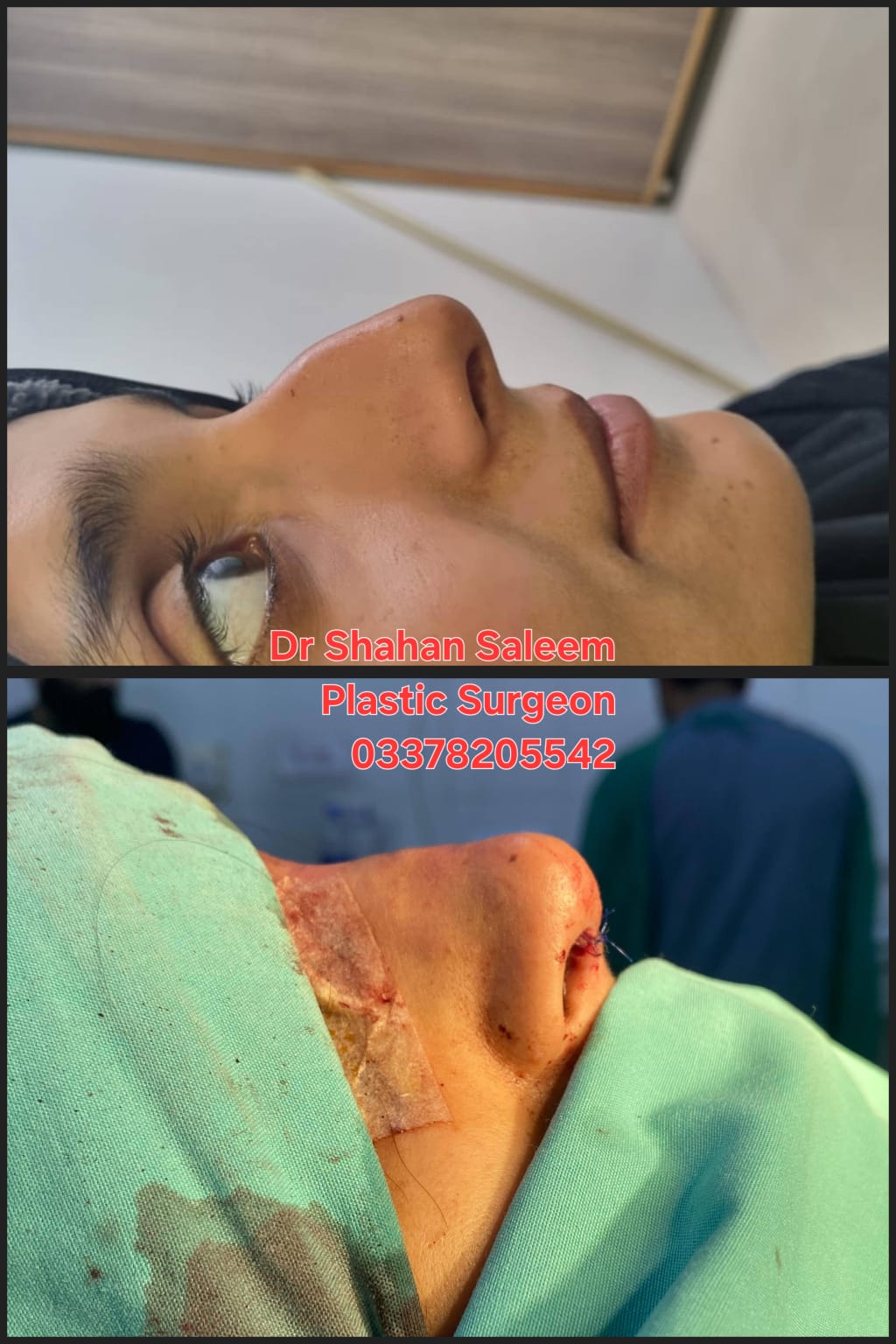 Before & After 22